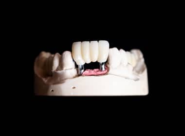 rehabilitacion dental, rehabilitación dental, odontologo rehabilitador oral, rehabilitacion bucal